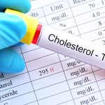 Jakie powinny być prawidłowe wyniki badania cholesterolu?