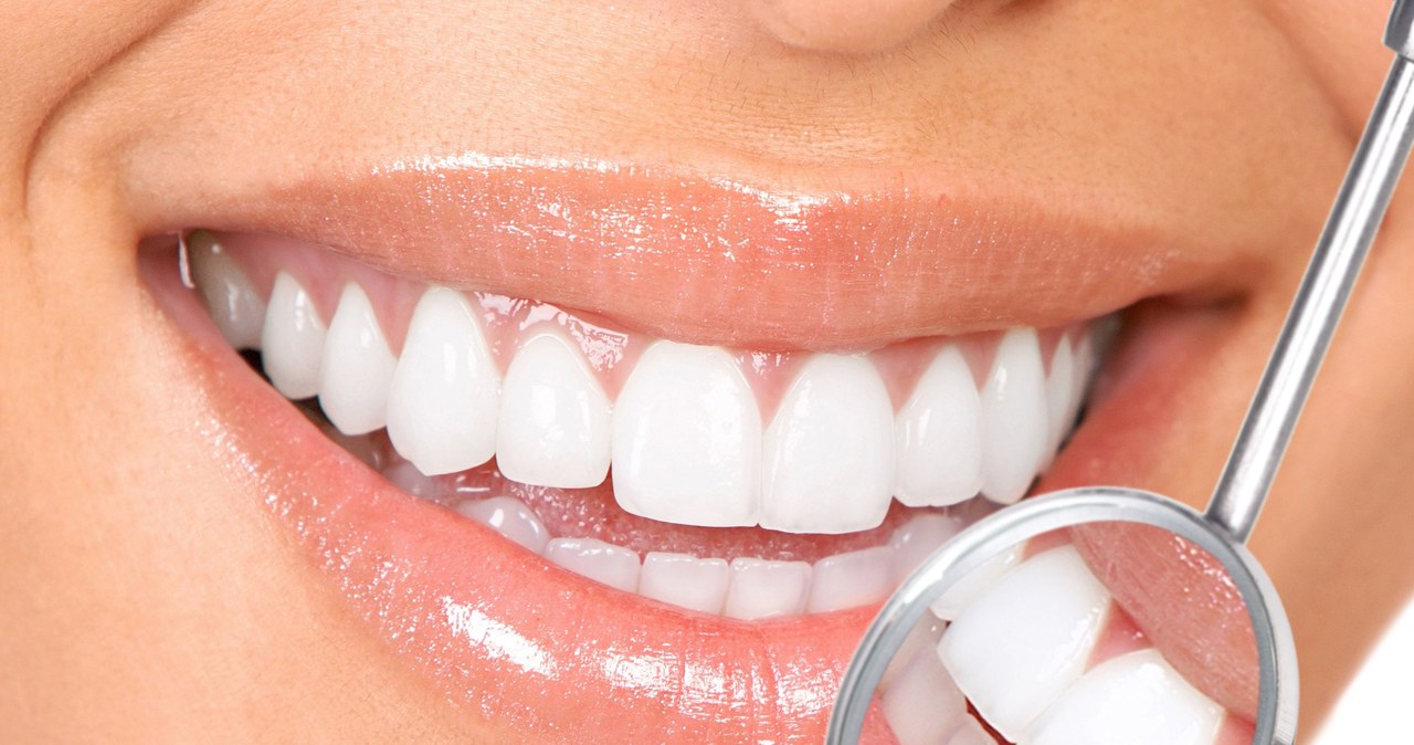 Jakie zabiegi dentystyczne są refundowane przez NFZ? /123RF/PICSEL