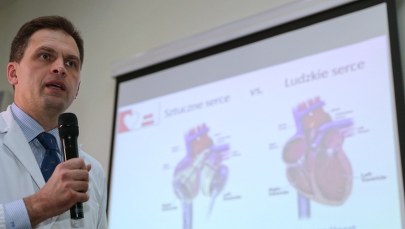 Jako pierwszy w Polsce miał wszczepione sztuczne serce. 67-latek opuścił szpital