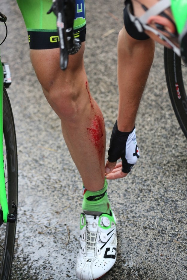 Jeden z kolarzy z okaleczoną nogą na mecie 6. etapu wyścigu Giro d'Italia z Sassano do Monte Cassino (257 km), w którym brzemienne w skutkach okazały się dwie następujące po sobie kraksy na rondzie przed finałową wspinaczką, 12 km przed metą. Na śliskiej od deszczu szosie przewróciło się kilkudziesięciu kolarzy. Najbardziej ucierpiał Włoch Giampaolo Caruso (Katiusza), którego karekta odwiozła do szpitala. /Leszek Szymański /PAP