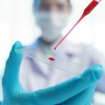 Jedna kropla krwi i 10 minut. Szybki test pomoże ratować rannych