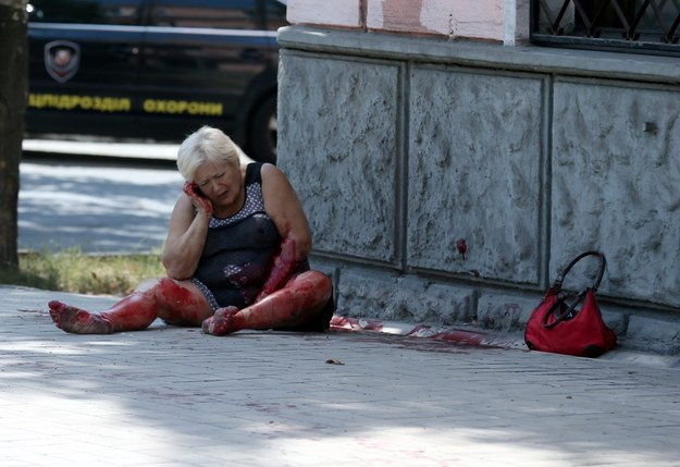 Jedna z rannych mieszkanek Doniecka /Sergei Ilnitsky /PAP/EPA