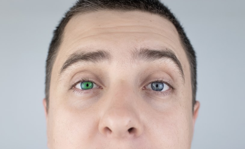 Jedno oko jest niebieskie, a drugie np. zielone? Może to być objaw choroby /123RF/PICSEL