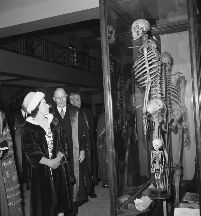 Jednym z najsłynniejszych gigantycznych szkieletów wystawianych na widok publiczny jest ten należący do Charlesa Byrne'a,  "Irlandzkiego Giganta" /PA Images /Getty Images