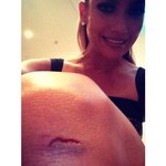 Jennifer Lopez rozbiła kolano