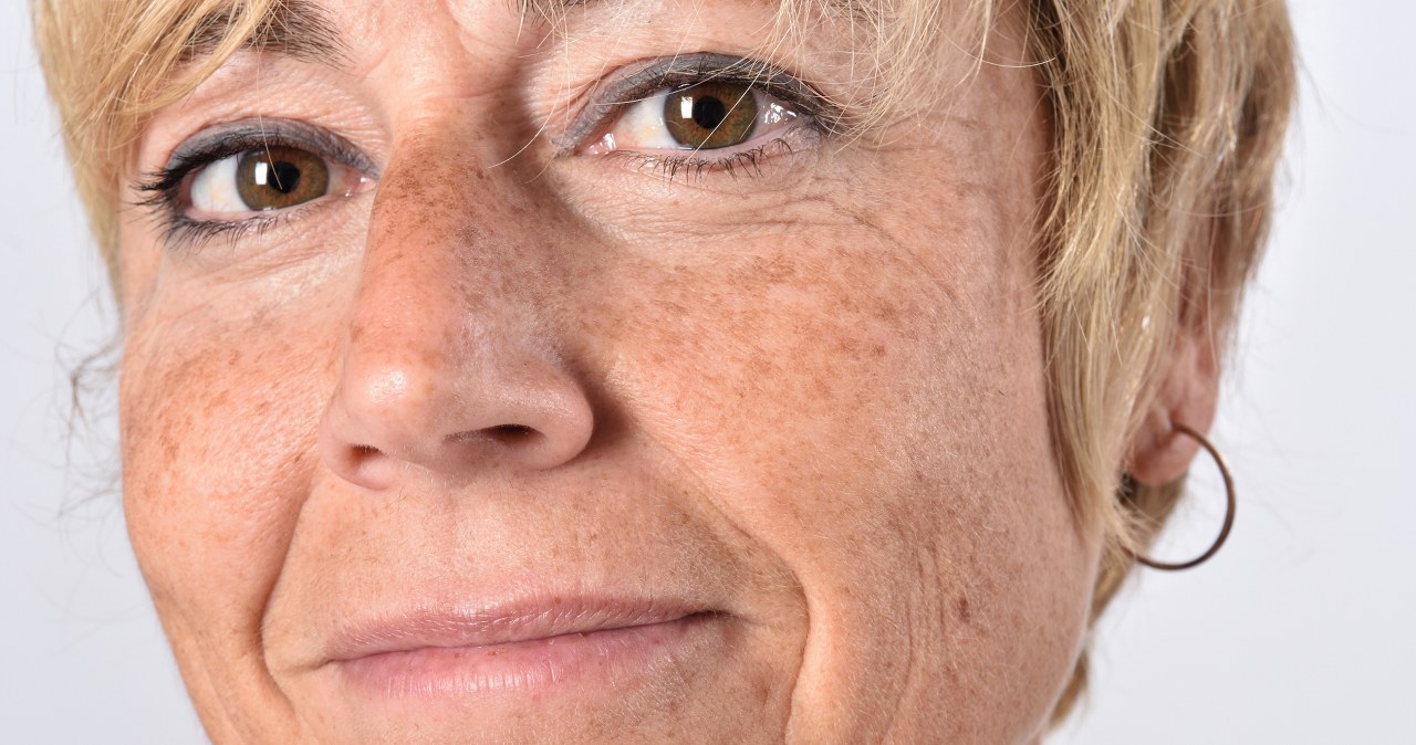 Jesień to najlepszy czas, jeśli chcesz rozjaśnić przebarwienia i piegi na twarzy /123RF/PICSEL