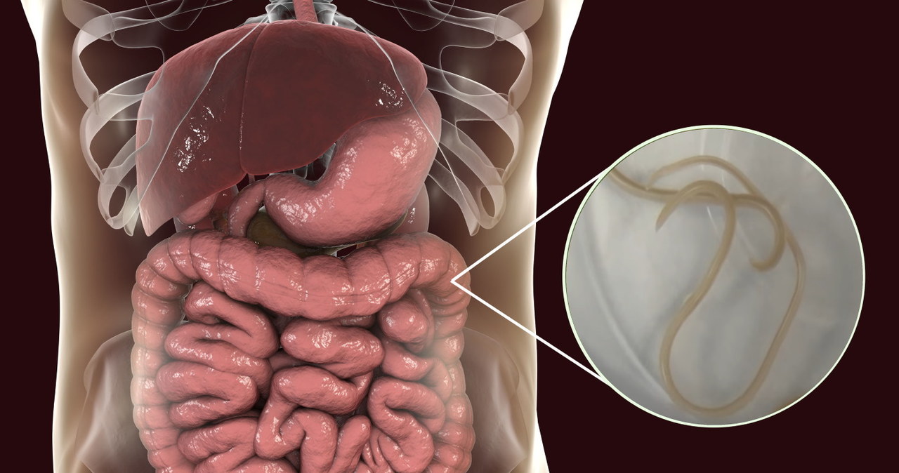 Jeśli dorosła glista dostaje się do organizmu, żyje w jelitach, powodując gorączkę, obrzęk i zapalenie płuc /123RF/PICSEL