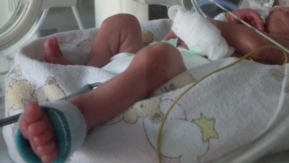 Jest areszt dla rodziców trzymiesięcznej Lenki. Dziecko ma pękniętą kość czołową