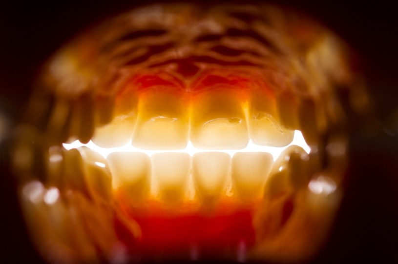 Jest gorszy od bólu zębów. Choć zaczyna się niewinnie, może prowadzić do przewlekłych chorób /123RF/PICSEL