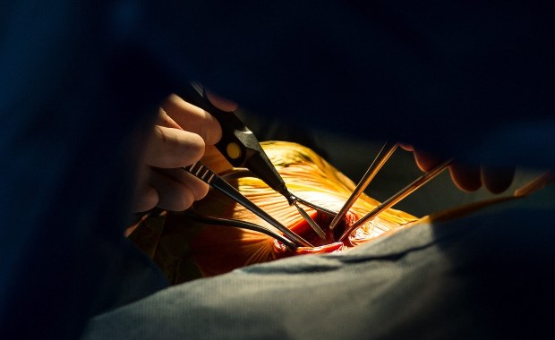 Jest propozycja ostrych cięć wycen świadczeń medycznych. Dotyczy m.in. kardiologii