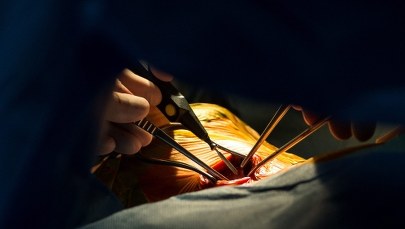 Jest propozycja ostrych cięć wycen świadczeń medycznych. Dotyczy m.in. kardiologii