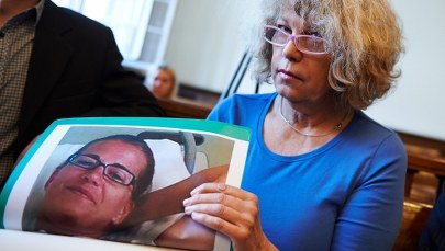 Jest wyrok za fatalną w skutkach operację plastyczną. Pacjentka ze Szwecji ma uszkodzony mózg