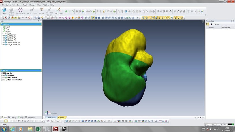 John Cousins na podstawie dancyh DICOM stworzył model 3D swojej nerki /East News