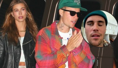 Justin Bieber doznał częściowego paraliżu twarzy. Wiemy, co się z nim dzieje teraz