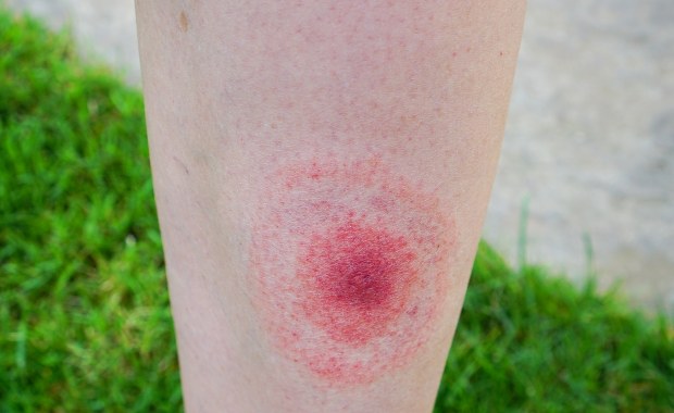 Justin Timberlake podzielił się diagnozą. "Życie z tą chorobą potrafi być bezlitośnie wyniszczające…”