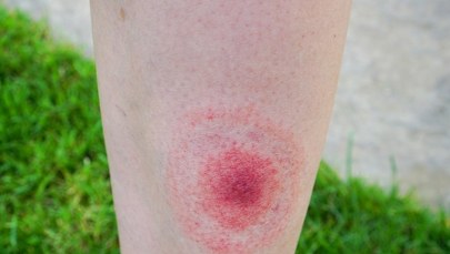 Justin Timberlake podzielił się diagnozą. "Życie z tą chorobą potrafi być bezlitośnie wyniszczające…”