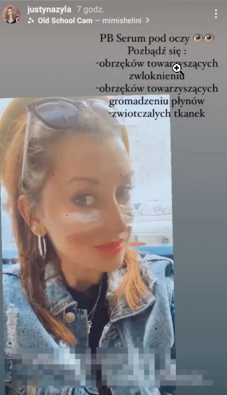 Justyna Żyła ostrzykuje się w gabinecie, fot. https://www.instagram.com/justynazyla/?hl=pl /Instagram