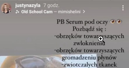 Justyna Żyła ostrzykuje się w gabinecie, fot. https://www.instagram.com/justynazyla/?hl=pl /Instagram