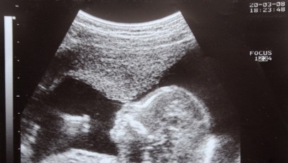 Już kilkadziesiąt ciąż w programie in vitro