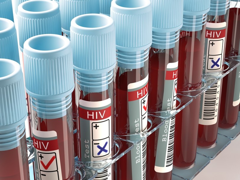 Już wkrótce powstanie szczepionka przeciwko HIV? /123RF/PICSEL