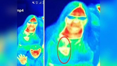 Kamera termowizyjna pomogła wykryć raka u 41-latki 