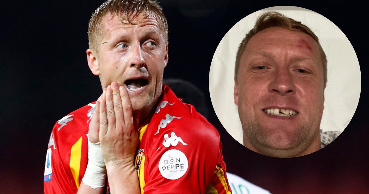 Kamil Glik na Instagramie pokazał, jak wygląda po wypadku @kamilglik25/ /Getty Images