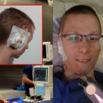 Kamil po 8 nieudanych operacjach wreszcie otrzymał ucho. Przełom w Warszawie