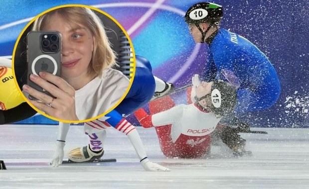 ​Kamila Sellier po operacji oczodołu. Opublikowała swoje zdjęcie