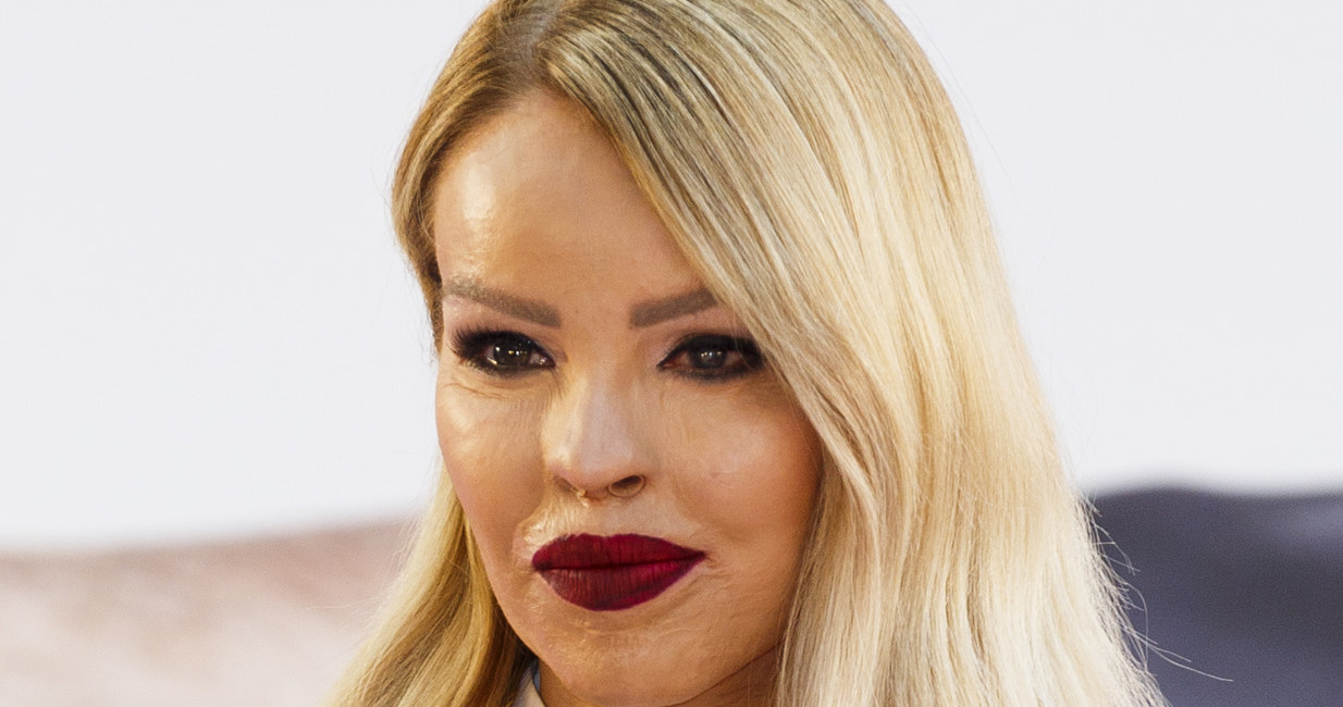 Katie Piper, 2016 rok /Tristan Fewings /Getty Images