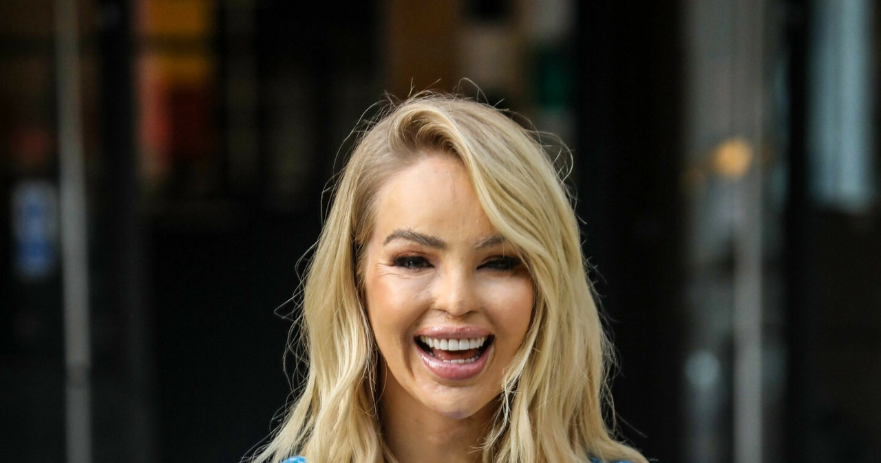 Katie Piper /East News