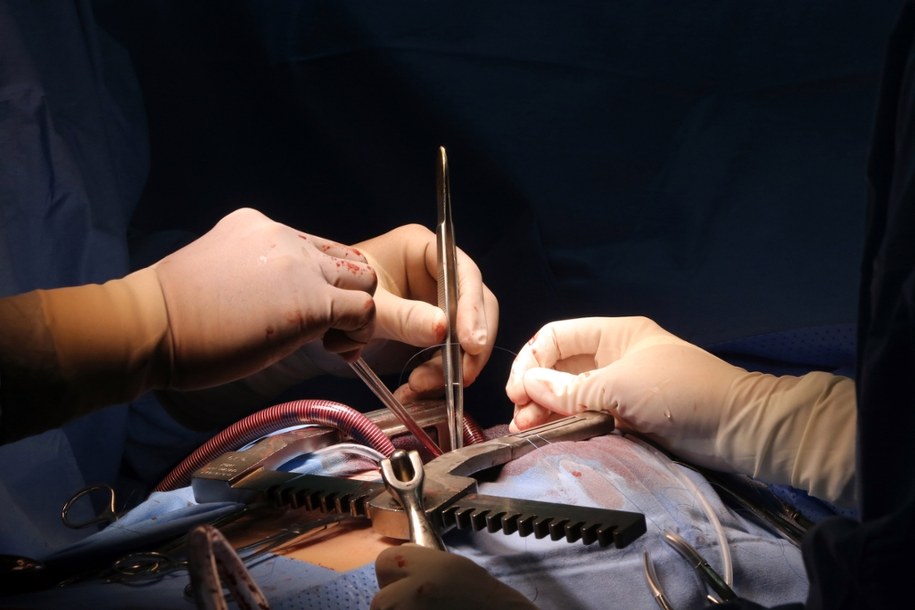 Dwa zabiegi naraz, by uniknąć nowego udaru. Śląski szpital z wyjątkową procedurą