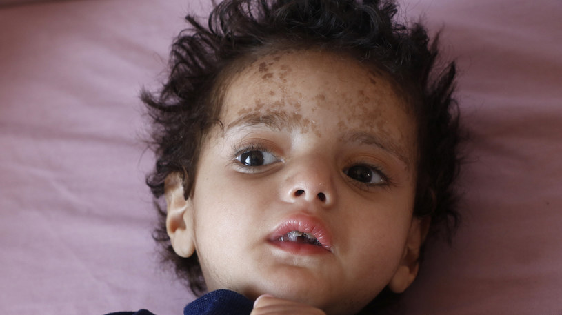 Każdy może zaangażować się w pomoc Jemenowi /Mohammed Hamoud/Getty Images /Getty Images