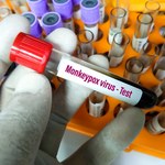 KE kupiła ponad 100 tys. dawek szczepionki przeciw małpiej ospie 