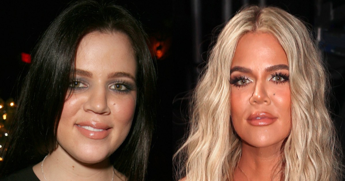 Khloe Kardashian przed i po operacji Foto: Christopher Polk / Enos Solomon/FilmMagic) /Getty Images