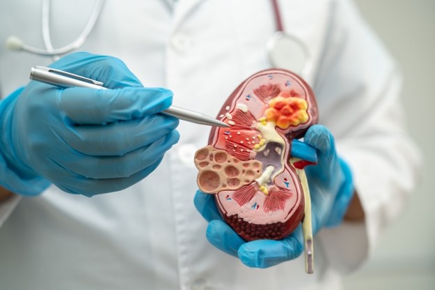 kidney disease /Shutterstock