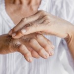 Kiedy sucha skóra to nie efekt zaniedbania. Choroby, które tak dają o sobie znać 