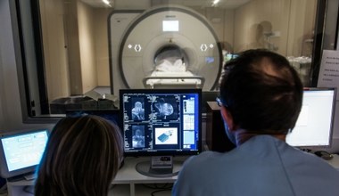 Kiedy tomografia komputerowa, a kiedy rezonans? Tym różnią się badania