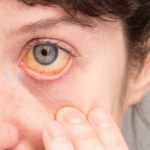 Kiedy tyka "wirusowa bomba zegarowa"? Usłysz ciche wołanie wątroby