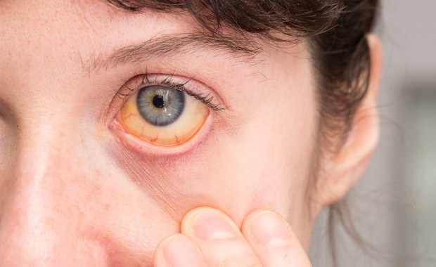 Kiedy tyka "wirusowa bomba zegarowa"? Usłysz ciche wołanie wątroby