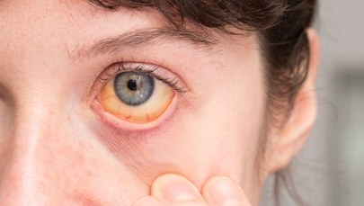 Kiedy tyka "wirusowa bomba zegarowa"? Usłysz ciche wołanie wątroby