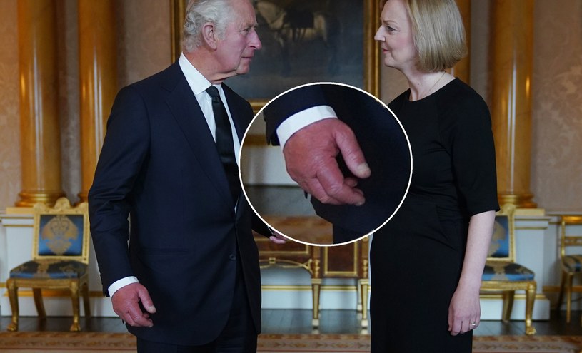 "Kiełbasiane palce" króla Karola III /Getty Images