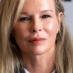 Kim Basinger przesadziła z botoksem?