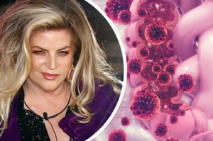 Kirstie Alley walczyła z rakiem jelita grubego. Przez długi czas choroba nie daje wyraźnych objawów