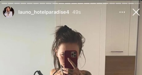 Klaudia z "Hotelu Paradise" przeszła operację! Foto: Instagram / @launo_hotelparadise4 /Instagram