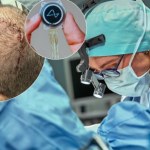 Klikanie myślami: Jak Neuralink Elona Muska przenosi granie na nowy poziom