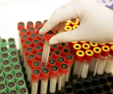 Klinika omyłkowo ujawniła dane pacjentów z HIV 