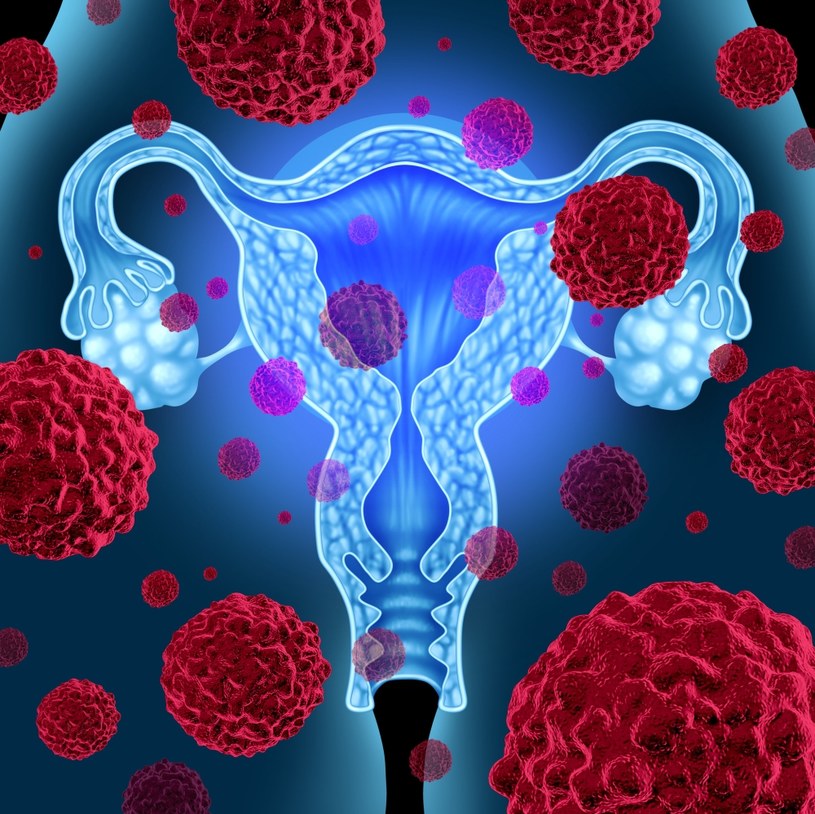 Kobiety z endometriozą często mają problem z zajściem w ciążę i leczone są z powodu bezpłodności /123RF/PICSEL