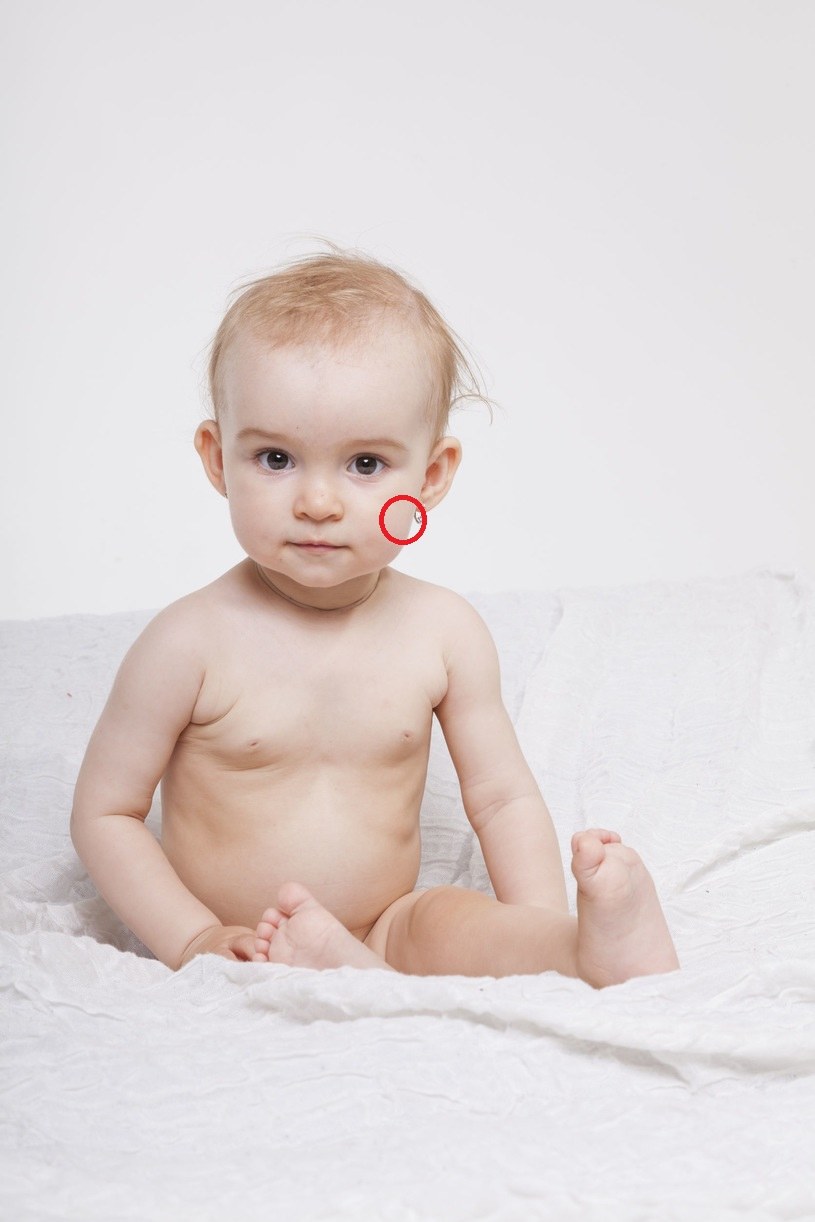Kolczyki w niemowlęcych uszkach to wątpliwa ozdoba, a całkiem realne zagrożenie /123RF/PICSEL