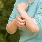 Kolor, którego nie lubią komary. Otocz się nim, a będziesz mieć spokój