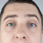 Kolor oczu może świadczyć o chorobie. Lepiej umów się do okulisty